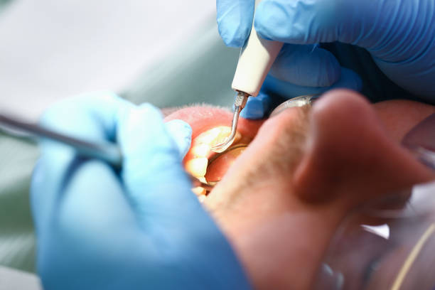 Best Emergency Gum Treatment in Livonia, LA