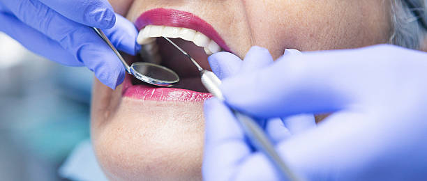 Best Emergency Treatment for Dental Infections or Abscesses in Livonia, LA